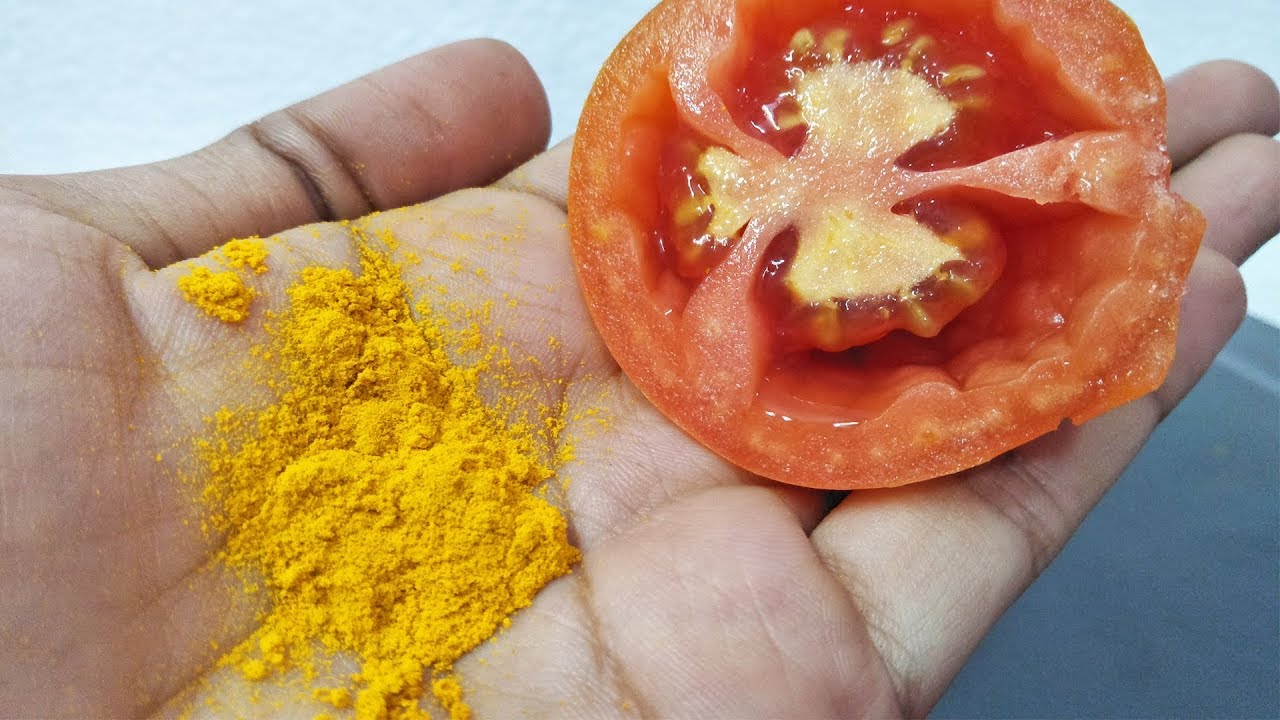 Home remedies for pimples